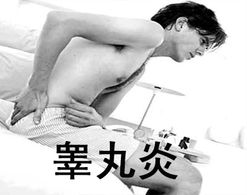 男性诊断自己患有睾丸炎的依据是什么呢